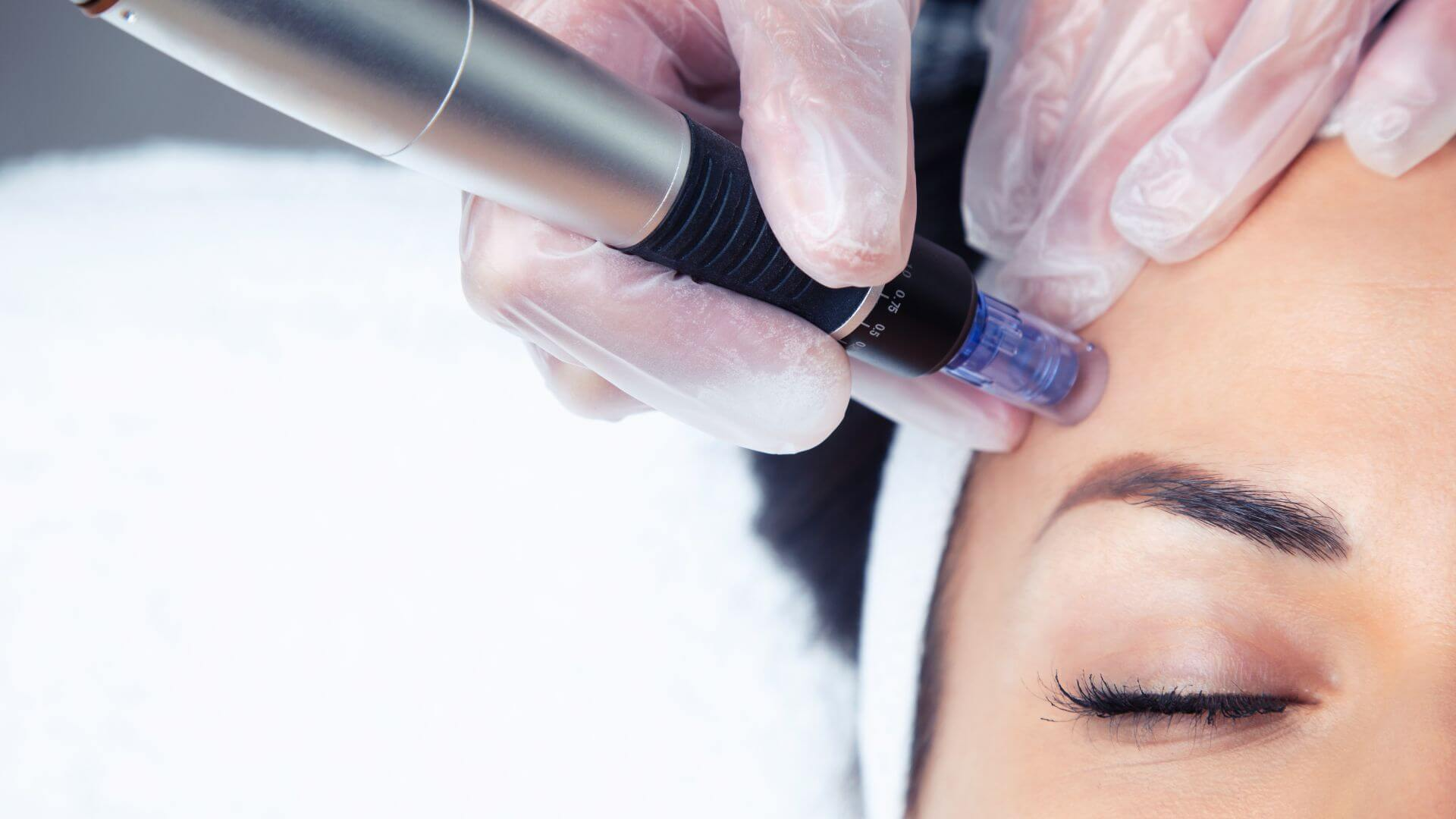 How Dermatologists Tailor Treatments for Unique Skin Types