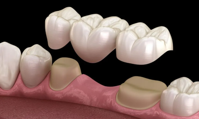 The Latest Advancements in Denture Technology