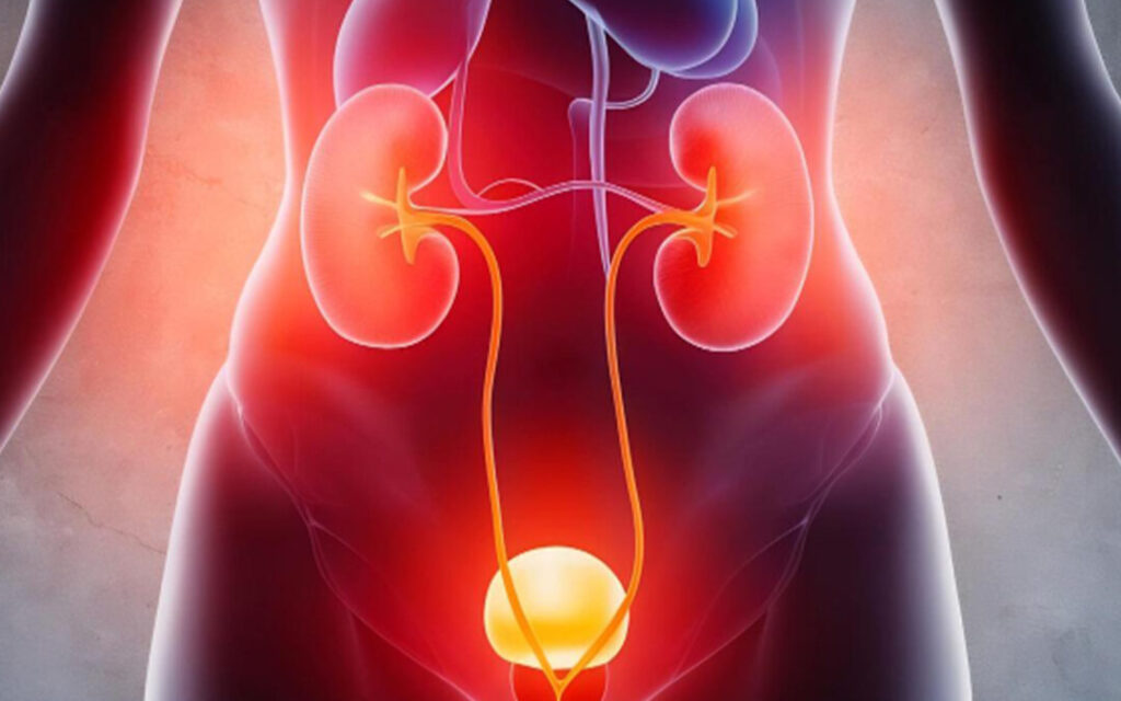 1. Helps Prevent Recurring Urinary Tract Infections (UTIs)